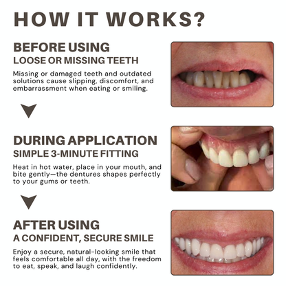 KLENIMORE™ 🦷Advanced Customized Full Denture Set🦷 (🔥10,000+ Sold In Last 30 Day)