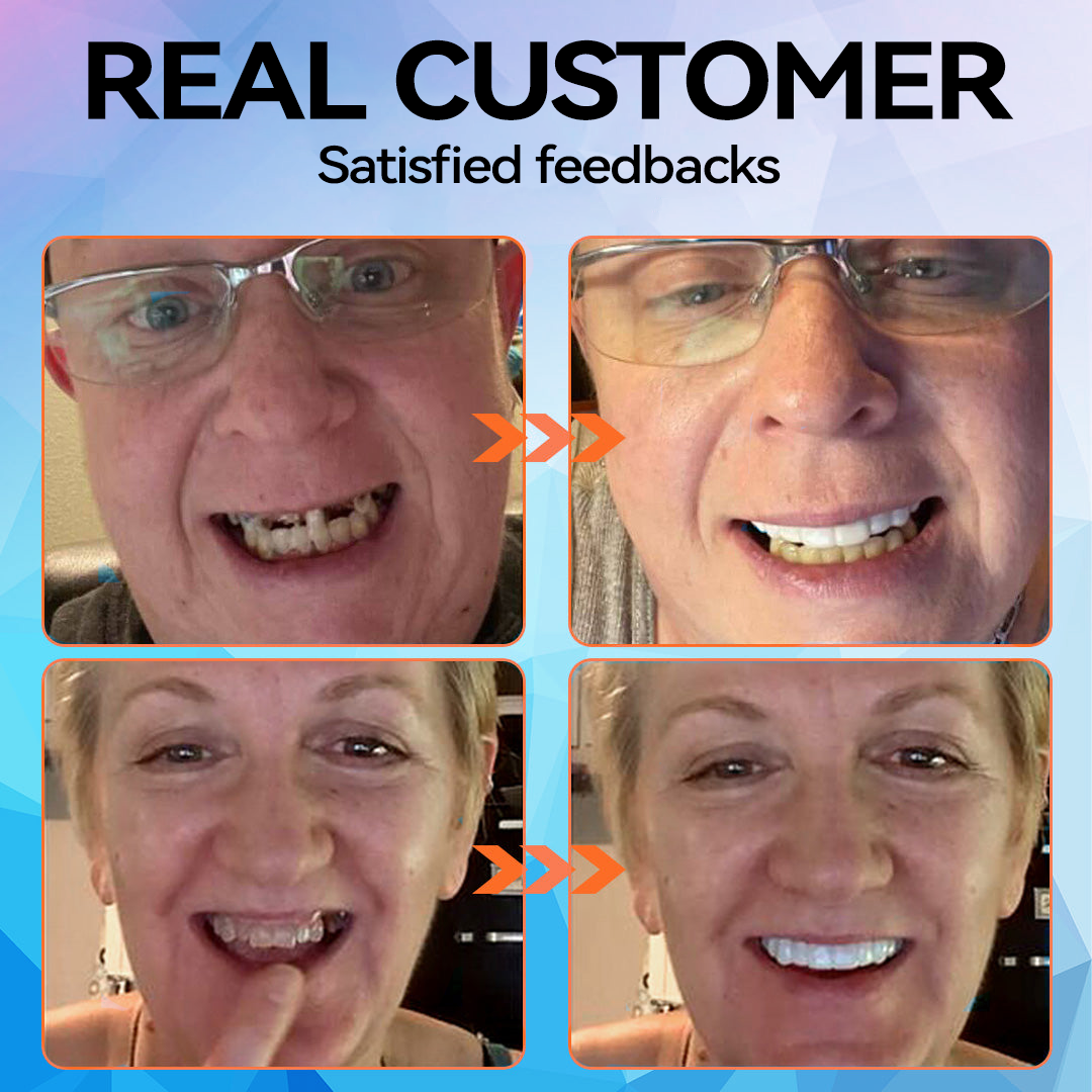 KLENIMORE™ 🦷  Silicone Reline Denture Set (⏰Limited Time 80% Off - Last 30 Minutes ⏰)