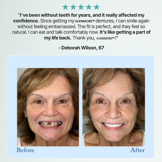 KLENIMORE™ 🦷Advanced Customized Full Denture Set🦷 (🔥10,000+ Sold In Last 30 Day)