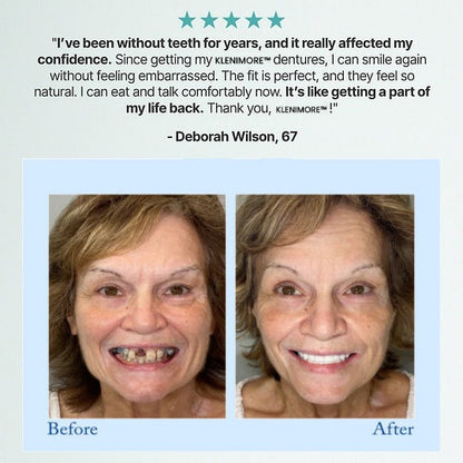 KLENIMORE™ 🦷Advanced Customized Full Denture Set🦷 (🔥10,000+ Sold In Last 30 Day)