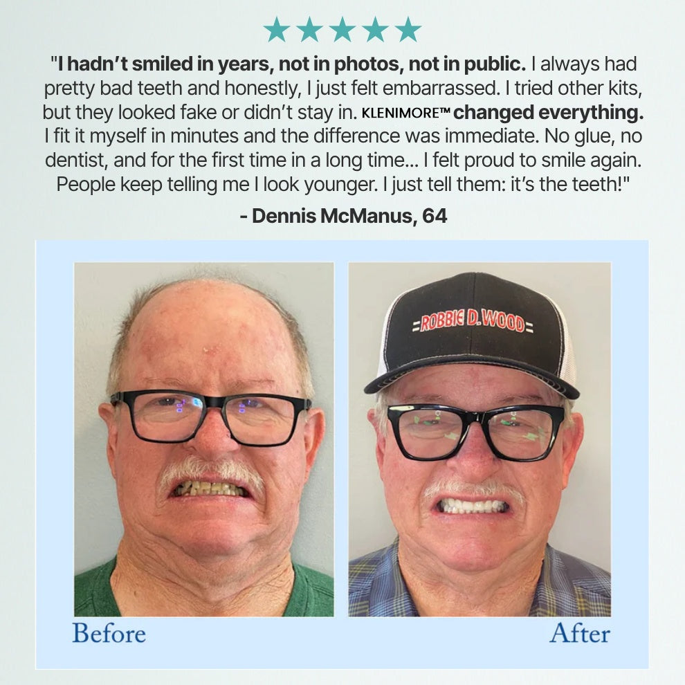 KLENIMORE™ 🦷Advanced Customized Full Denture Set🦷 (🔥10,000+ Sold In Last 30 Day)