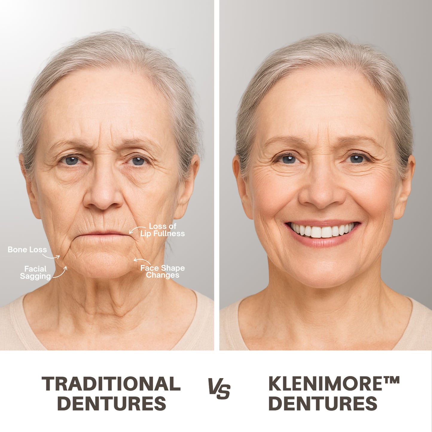 KLENIMORE™ 🦷Advanced Customized Full Denture Set🦷 (🔥10,000+ Sold In Last 30 Day)