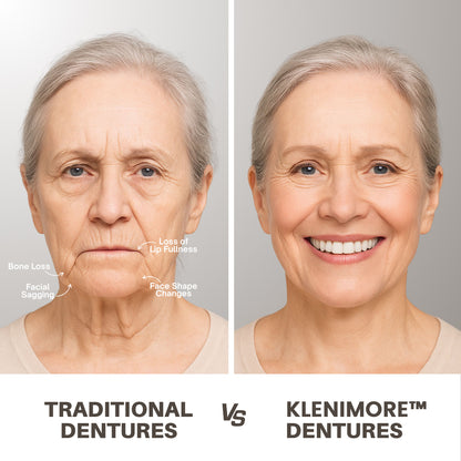 KLENIMORE™ 🦷Advanced Customized Full Denture Set🦷 (🔥10,000+ Sold In Last 30 Day)
