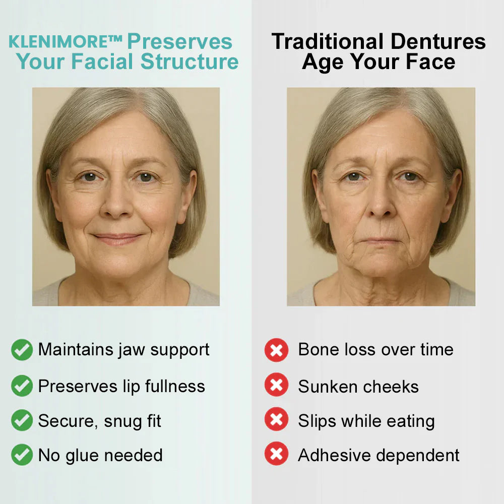 KLENIMORE™🦷🦷 𝗔𝗱𝘃𝗮𝗻𝗰𝗲𝗱 𝗖𝘂𝘀𝘁𝗼𝗺𝗶𝘇𝗲𝗱 𝗙𝘂𝗹𝗹 𝗗𝗲𝗻𝘁𝘂𝗿𝗲 𝗦𝗲𝘁  （✅Clinically backed comfort-fit dentures —  Trusted by 80,000+ US users for all-day comfort.）