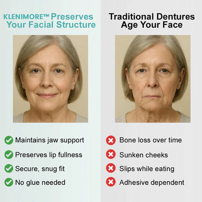 KLENIMORE™🦷🦷 𝗔𝗱𝘃𝗮𝗻𝗰𝗲𝗱 𝗖𝘂𝘀𝘁𝗼𝗺𝗶𝘇𝗲𝗱 𝗙𝘂𝗹𝗹 𝗗𝗲𝗻𝘁𝘂𝗿𝗲 𝗦𝗲𝘁  （✅Clinically backed comfort-fit dentures —  Trusted by 80,000+ US users for all-day comfort.）