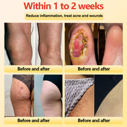 𝐀𝐝𝐯𝐚𝐧𝐜𝐞𝐝 𝐓𝐢𝐭𝐚𝐧𝐢𝐮𝐦 𝐒𝐡𝐚𝐩𝐢𝐧𝐠 𝐒𝐡𝐨𝐫𝐭𝐬 𝐰𝐢𝐭𝐡 𝐒𝐞𝐥𝐟-𝐇𝐞𝐚𝐭𝐢𝐧𝐠 𝐓𝐨𝐮𝐫𝐦𝐚𝐥𝐢𝐧𝐞 𝐓𝐡𝐞𝐫𝐚𝐩𝐲🎁🎁