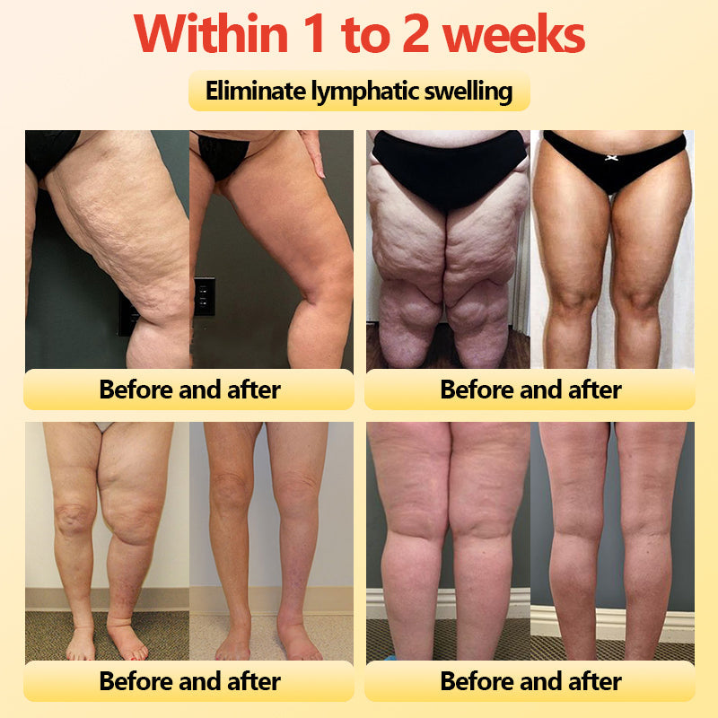 𝐀𝐝𝐯𝐚𝐧𝐜𝐞𝐝 𝐓𝐢𝐭𝐚𝐧𝐢𝐮𝐦 𝐒𝐡𝐚𝐩𝐢𝐧𝐠 𝐒𝐡𝐨𝐫𝐭𝐬 𝐰𝐢𝐭𝐡 𝐒𝐞𝐥𝐟-𝐇𝐞𝐚𝐭𝐢𝐧𝐠 𝐓𝐨𝐮𝐫𝐦𝐚𝐥𝐢𝐧𝐞 𝐓𝐡𝐞𝐫𝐚𝐩𝐲🎁🎁