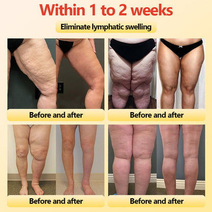 𝐀𝐝𝐯𝐚𝐧𝐜𝐞𝐝 𝐓𝐢𝐭𝐚𝐧𝐢𝐮𝐦 𝐒𝐡𝐚𝐩𝐢𝐧𝐠 𝐒𝐡𝐨𝐫𝐭𝐬 𝐰𝐢𝐭𝐡 𝐒𝐞𝐥𝐟-𝐇𝐞𝐚𝐭𝐢𝐧𝐠 𝐓𝐨𝐮𝐫𝐦𝐚𝐥𝐢𝐧𝐞 𝐓𝐡𝐞𝐫𝐚𝐩𝐲🎁🎁