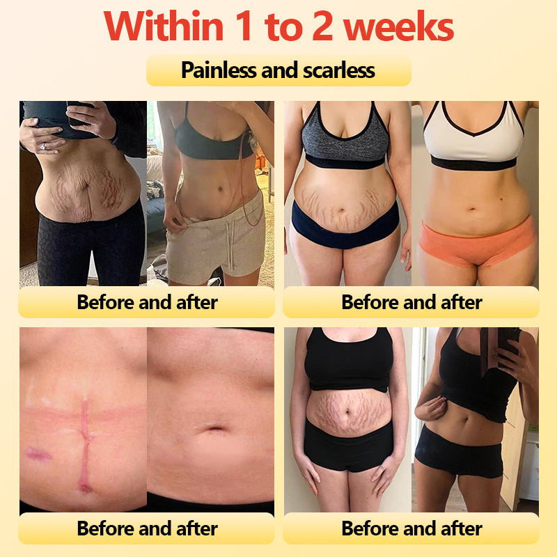 𝐀𝐝𝐯𝐚𝐧𝐜𝐞𝐝 𝐓𝐢𝐭𝐚𝐧𝐢𝐮𝐦 𝐒𝐡𝐚𝐩𝐢𝐧𝐠 𝐒𝐡𝐨𝐫𝐭𝐬 𝐰𝐢𝐭𝐡 𝐒𝐞𝐥𝐟-𝐇𝐞𝐚𝐭𝐢𝐧𝐠 𝐓𝐨𝐮𝐫𝐦𝐚𝐥𝐢𝐧𝐞 𝐓𝐡𝐞𝐫𝐚𝐩𝐲🎁🎁