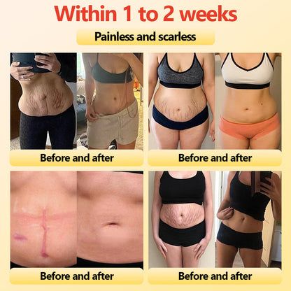 𝐀𝐝𝐯𝐚𝐧𝐜𝐞𝐝 𝐓𝐢𝐭𝐚𝐧𝐢𝐮𝐦 𝐒𝐡𝐚𝐩𝐢𝐧𝐠 𝐒𝐡𝐨𝐫𝐭𝐬 𝐰𝐢𝐭𝐡 𝐒𝐞𝐥𝐟-𝐇𝐞𝐚𝐭𝐢𝐧𝐠 𝐓𝐨𝐮𝐫𝐦𝐚𝐥𝐢𝐧𝐞 𝐓𝐡𝐞𝐫𝐚𝐩𝐲🎁🎁