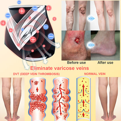 𝐀𝐝𝐯𝐚𝐧𝐜𝐞𝐝 𝐓𝐢𝐭𝐚𝐧𝐢𝐮𝐦 𝐒𝐡𝐚𝐩𝐢𝐧𝐠 𝐒𝐡𝐨𝐫𝐭𝐬 𝐰𝐢𝐭𝐡 𝐒𝐞𝐥𝐟-𝐇𝐞𝐚𝐭𝐢𝐧𝐠 𝐓𝐨𝐮𝐫𝐦𝐚𝐥𝐢𝐧𝐞 𝐓𝐡𝐞𝐫𝐚𝐩𝐲🎁🎁