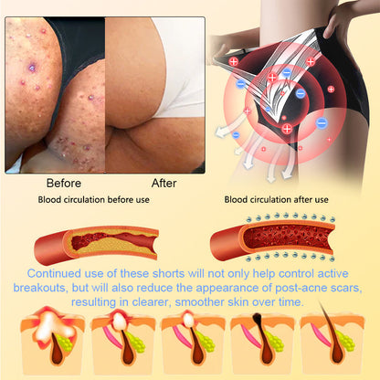 𝐀𝐝𝐯𝐚𝐧𝐜𝐞𝐝 𝐓𝐢𝐭𝐚𝐧𝐢𝐮𝐦 𝐒𝐡𝐚𝐩𝐢𝐧𝐠 𝐒𝐡𝐨𝐫𝐭𝐬 𝐰𝐢𝐭𝐡 𝐒𝐞𝐥𝐟-𝐇𝐞𝐚𝐭𝐢𝐧𝐠 𝐓𝐨𝐮𝐫𝐦𝐚𝐥𝐢𝐧𝐞 𝐓𝐡𝐞𝐫𝐚𝐩𝐲🎁🎁